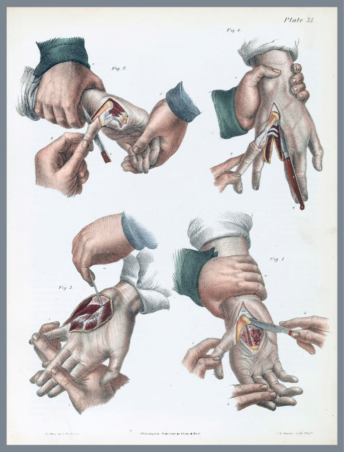 Designer decoration Poster.Medical Surgery.Home room Decor art print.q469